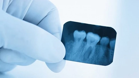 Прицельный снимок